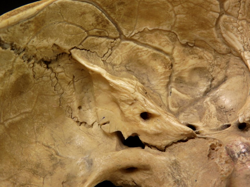 Cranium - os petrosum (basis cranii) 2