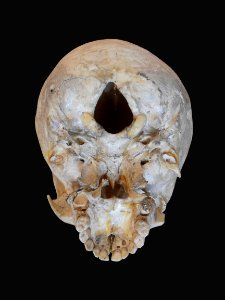 Cranium - baby, inferior view