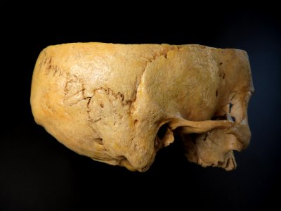 Cranium - lateral view