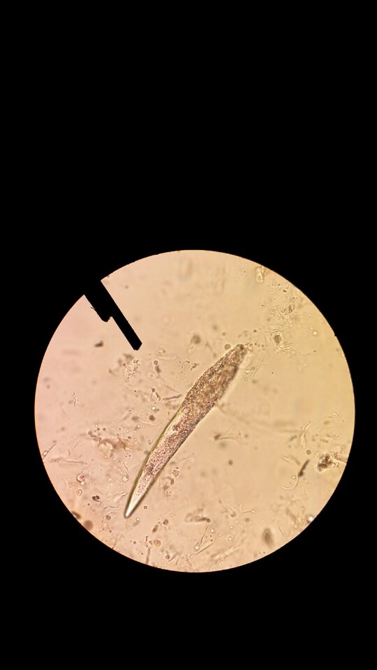 Demodex microscope skin mite
