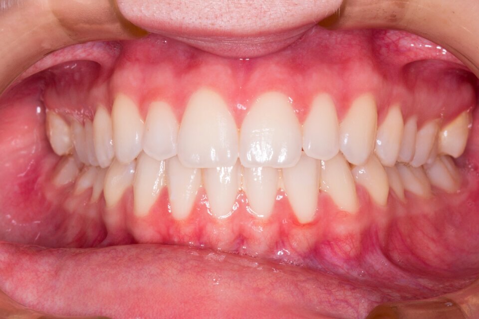 Teeth smile dentist