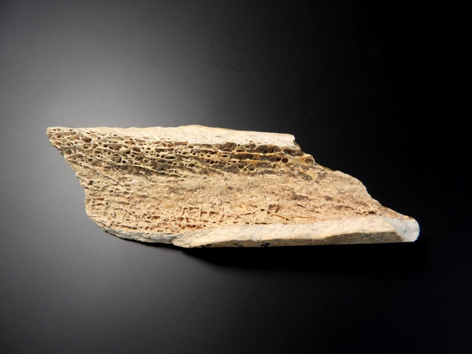Detail of human long bone tissue