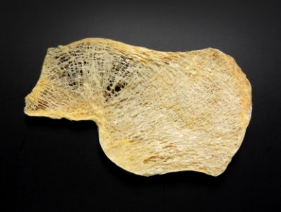 Detail of human bone tissue photo