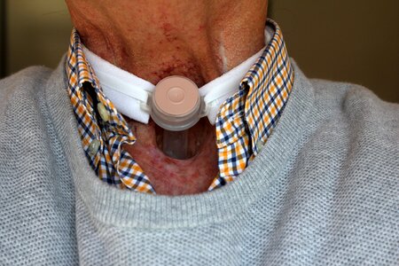 Stoma larynx surgical