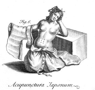 Engelbert-Kaempfer-Acupunctura-Japonica-1727