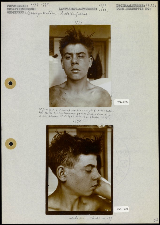 Foto 1 Pekzweren bij een 15-jarige arbeider, drie maanden werkzaam als briketv…, Bestanddeelnr 256-1929256-1930
