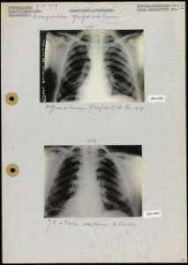 Foto 1 Röntgenfoto van H. Groen te Leerdam (8x11,5 cm Fotograaf onbekend) Fot…, Bestanddeelnr 256-1901256-1902