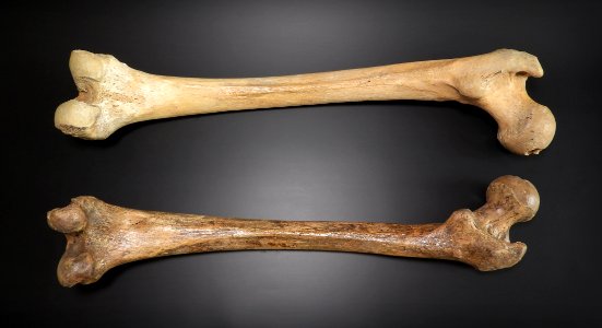 Femur - posterior view (sin, dex)
