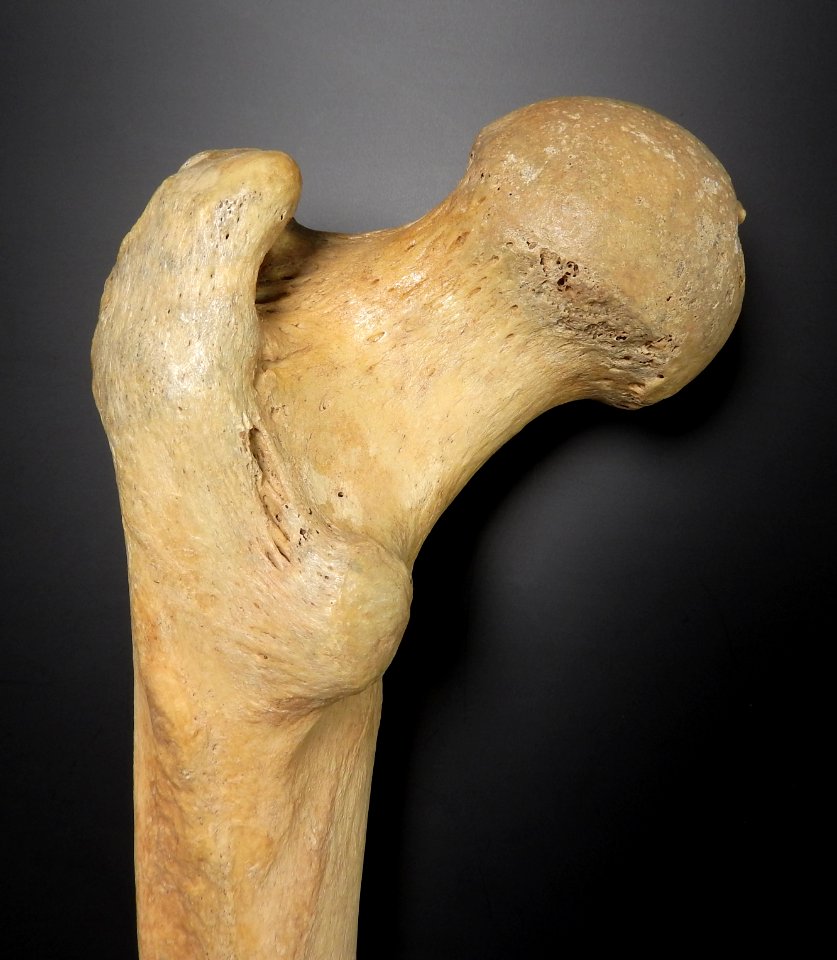 Femur - caput femoris (posterior)