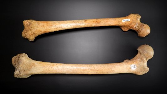 Femur - anterior view (sin, dex)