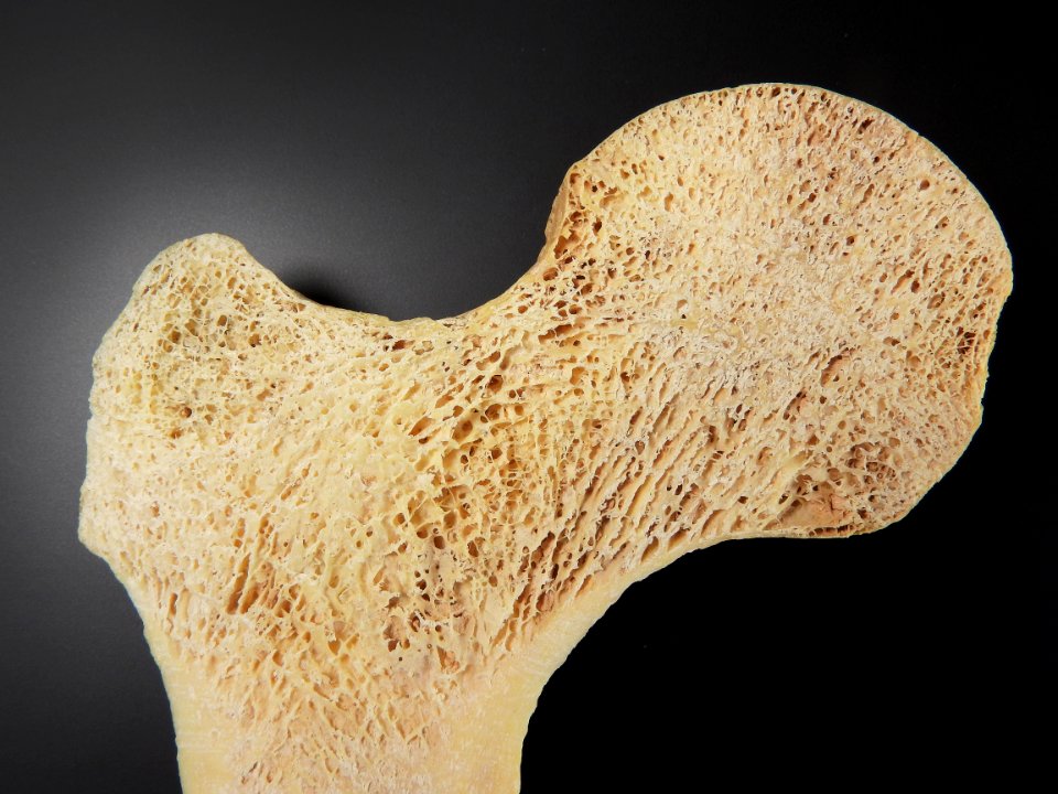 Femur (caput femoris) - bone structure detail (vertical cut) 2