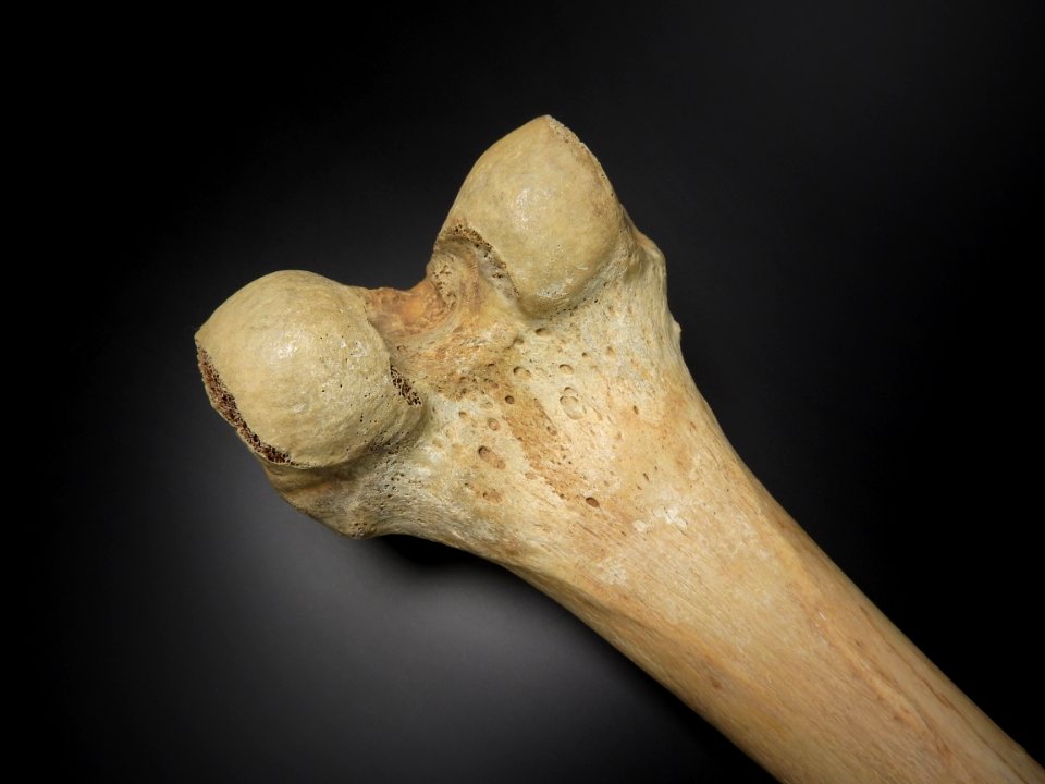 Femur - epicondylus lateralis et medialis (posterior view)