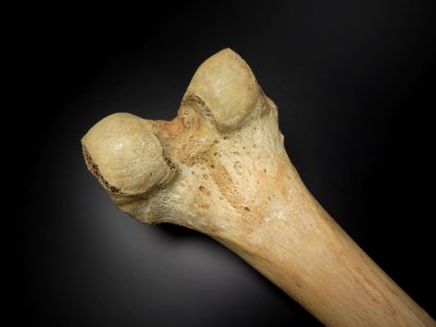 Femur - epicondylus lateralis et medialis (posterior view)