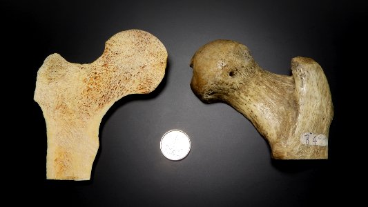 Femur (caput femoris) - bone structure detail (vertical cut) 3