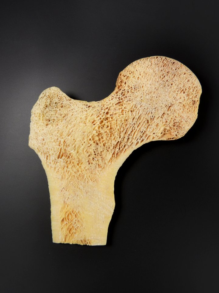 Femur (caput femoris) - bone structure detail (vertical cut)