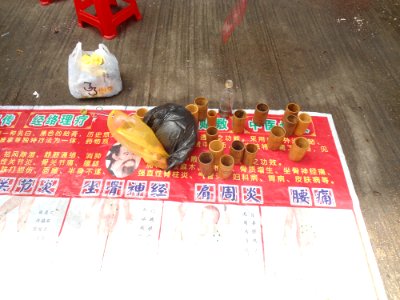 Fire cupping in Haikou - 05
