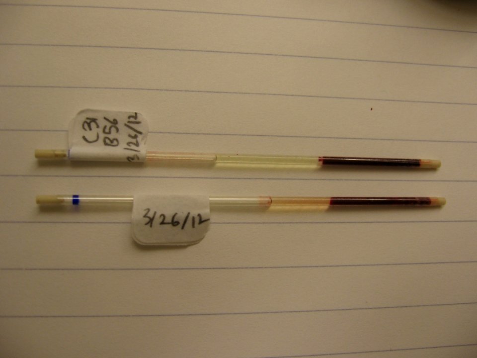 Hematocrit
