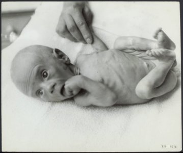 Hongerwinter Ondervoede baby, Bestanddeelnr 120-0716