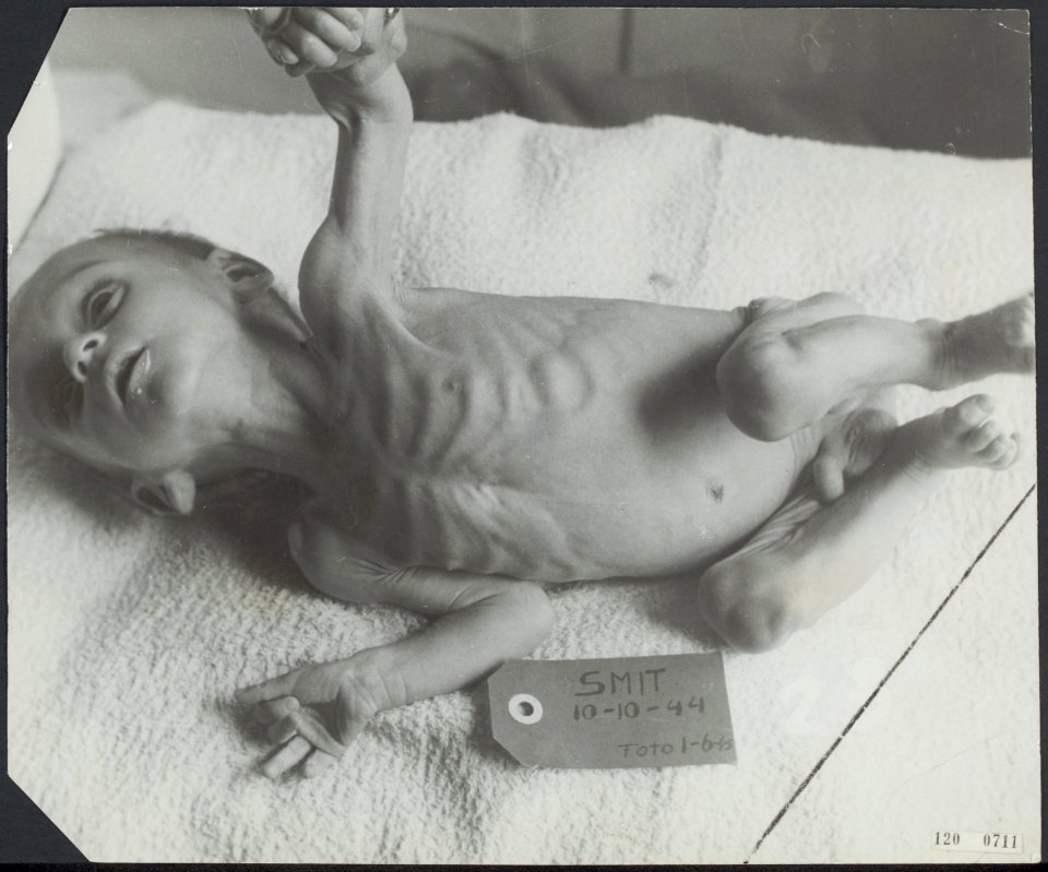 Hongerwinter. Slachtoffer. Baby. Den Helder, Bestanddeelnr 120-0711