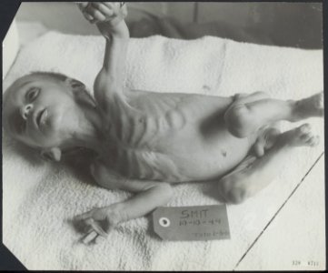 Hongerwinter. Slachtoffer. Baby. Den Helder, Bestanddeelnr 120-0711