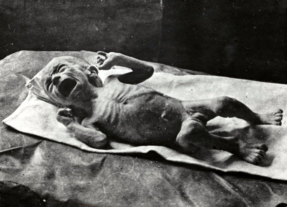 Hongerwinter, vier maanden oude baby lijdend aan ondervoeding, Bestanddeelnr 512 162