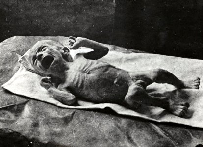 Hongerwinter, vier maanden oude baby lijdend aan ondervoeding, Bestanddeelnr 512 162
