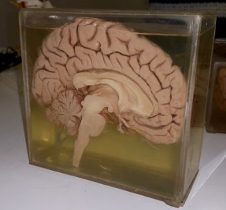 Human brain, sagittal section 1