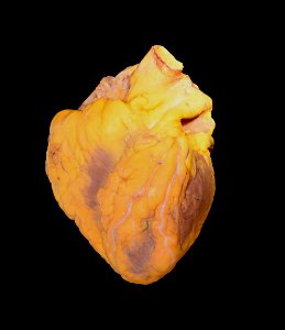 Human heart male adult autopsy photo