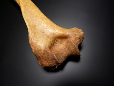 Humerus - olecranon fossa (posterior)