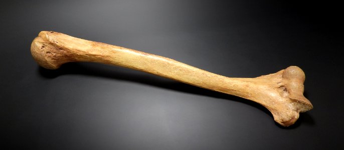 Humerus - anterior
