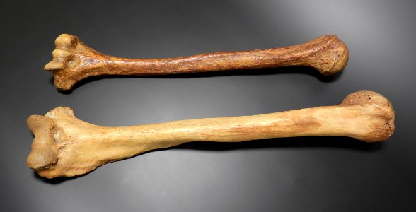 Humerus - anterior 2