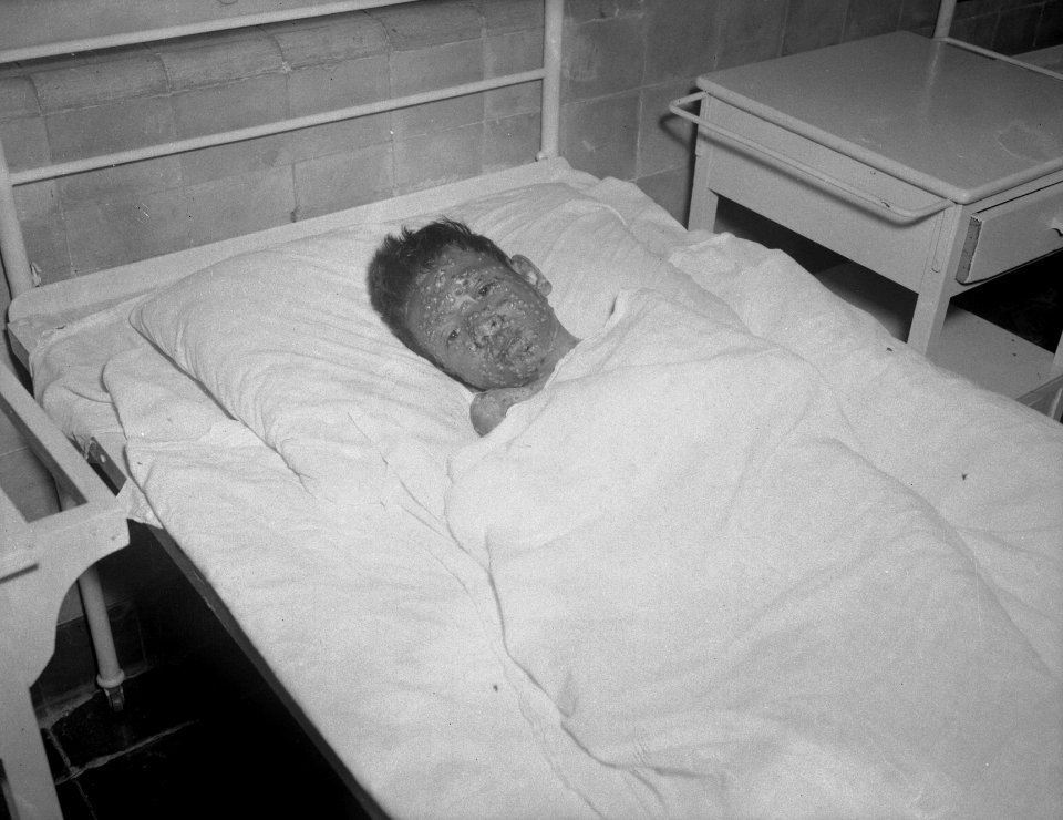 Jongen ligt in een ziekenhuisbed, Bestanddeelnr 15329