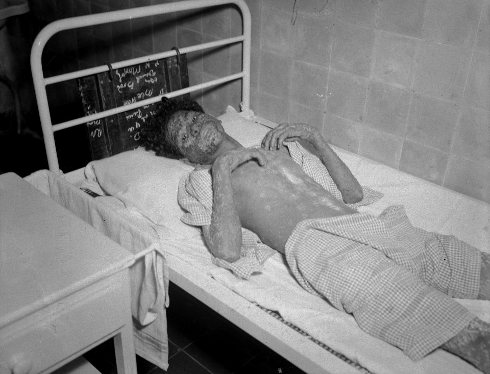 Jongen ligt in een ziekenhuisbed, Bestanddeelnr 15330