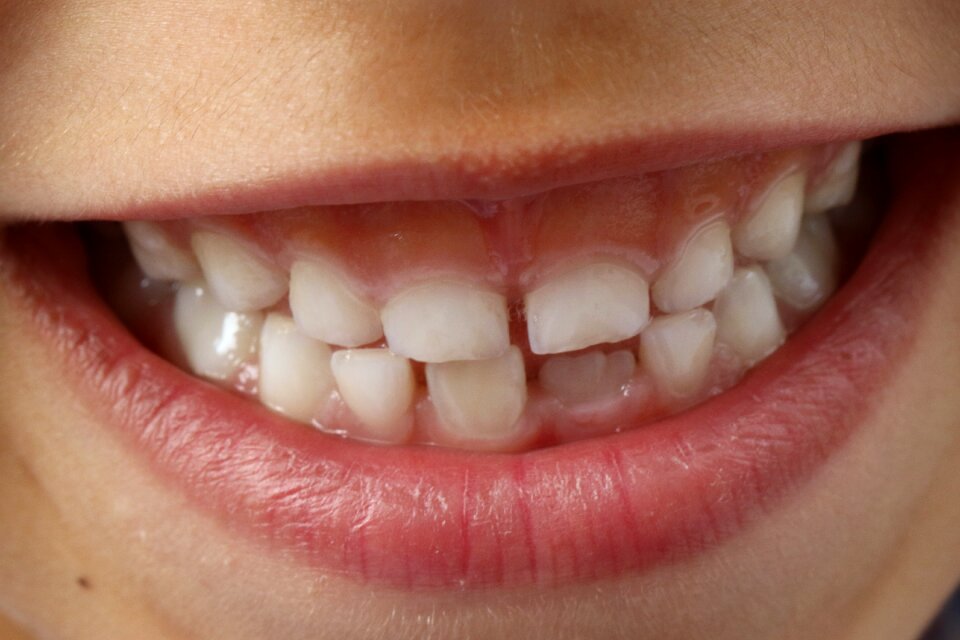 Dental smile teeth tooth