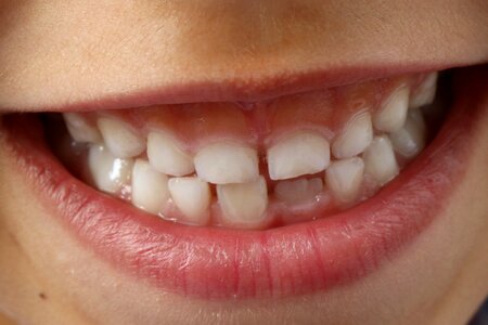 Dental smile teeth tooth photo