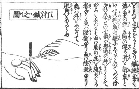 Japanese-tapping-needle-Shinkyu-chohoki-1718 photo