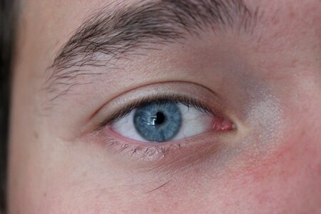 Eye boy about