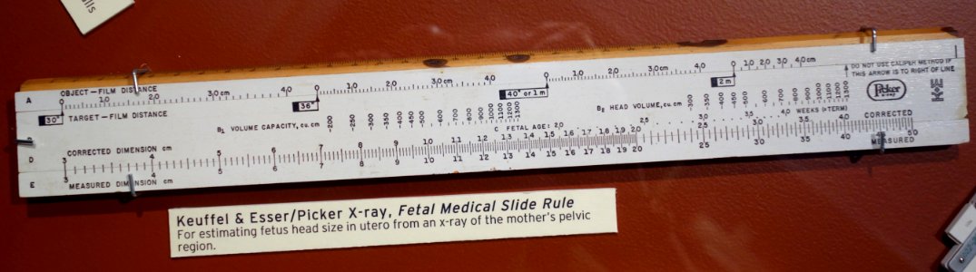 Keuffel & Esser - Picker X-ray, Fetal Medical Slide Rule - MIT Slide Rule Collection - DSC03680