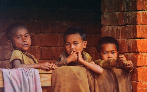 Three kids undernutrition malnutrition