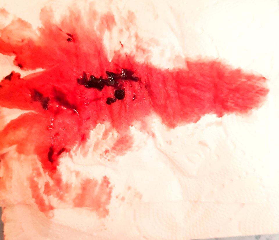Menstrual blood on toilet paper 