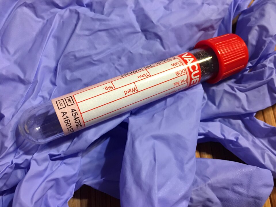 Laboratory the test diagnostics