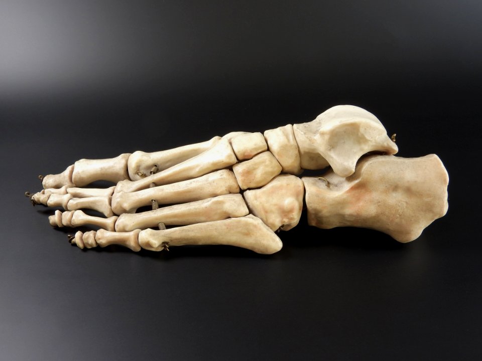 Ossa pedis (sin) - lateral view