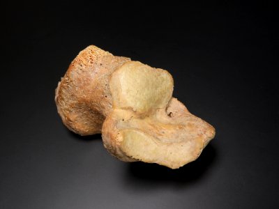 Ossa pedis (sin) - calcaneus (facies articularis talaris)