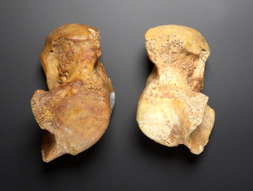 Ossa pedis - talus (lateral view, dex, sin)