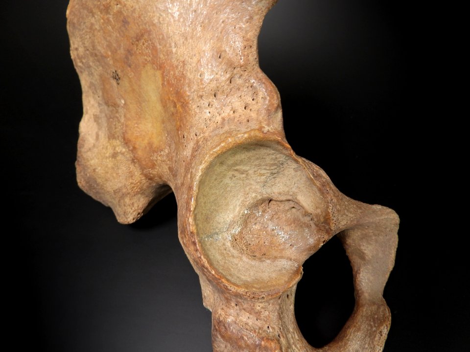 Pelvis - acetabulum (os coxae)