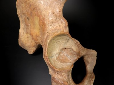 Pelvis - acetabulum (os coxae)