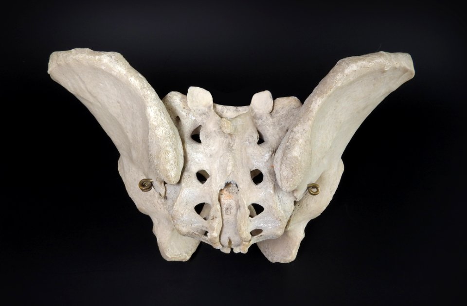 Pelvis - os coxae, os sacrum (posterior view)