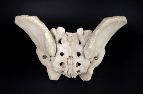 Pelvis - os coxae, os sacrum (posterior view) photo