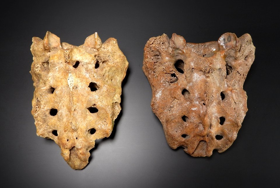 Pelvis - os sacrum (posterior) 2