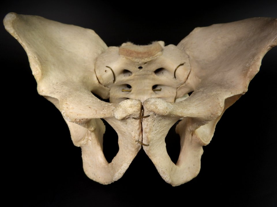 Pelvis - os coxae, os sacrum (frontal view)